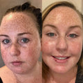 before and after of girl using Pomegranate Brightening Serum