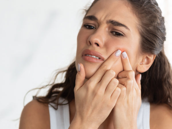 How To Get Rid of Pimples