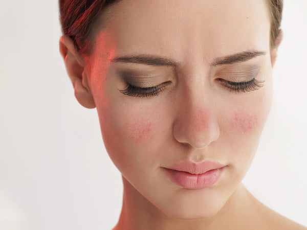 Why Is My Face Red? | Triggers & Tips | esmi Skin Minerals