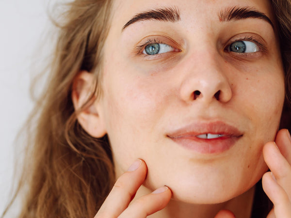 How to Get Rid of Dark Circles