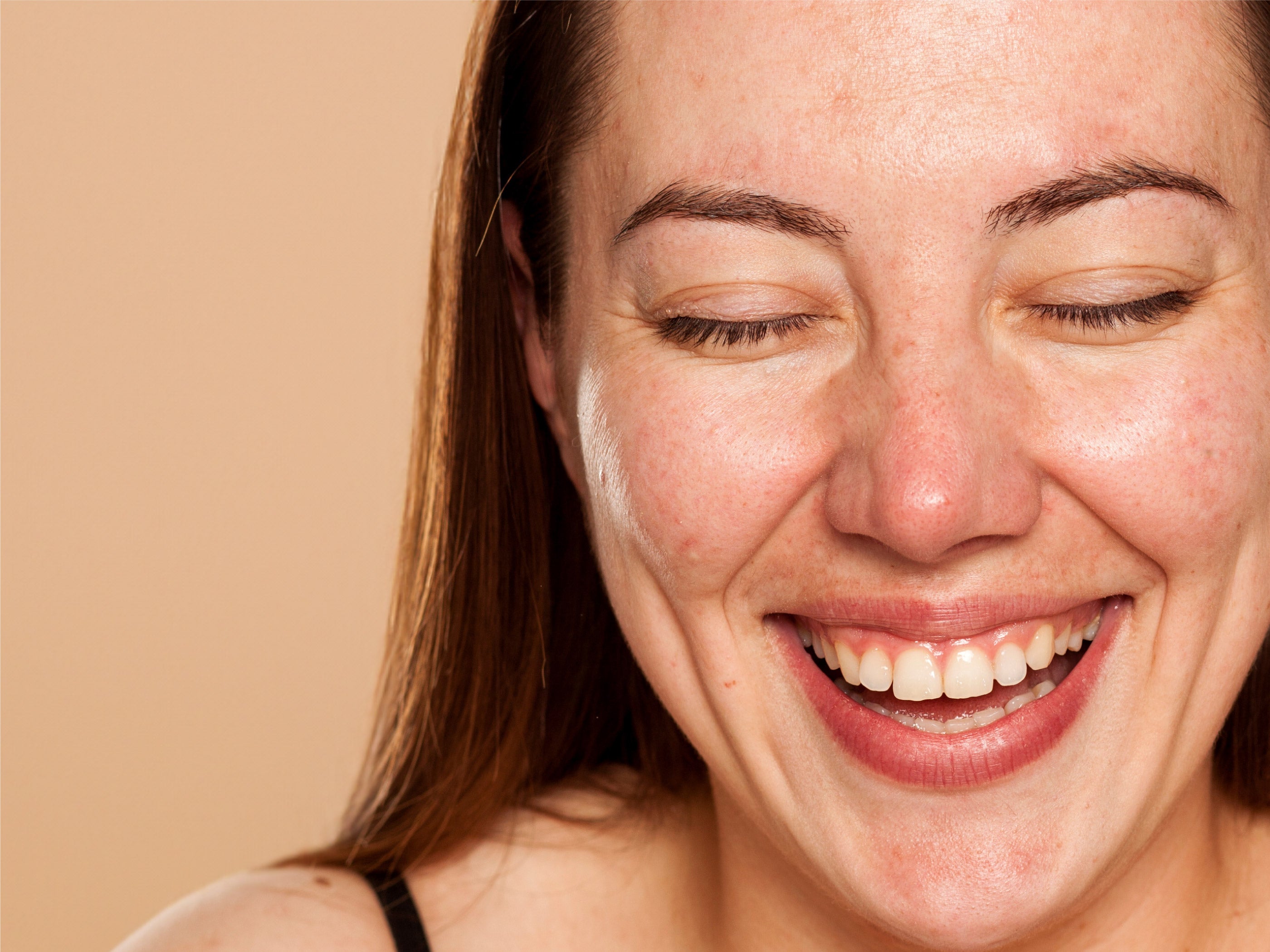 Isotretinoin purchase