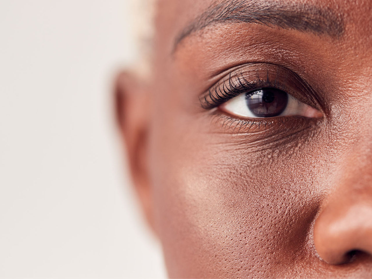 Treating Dry Skin Under Eyes esmi Skin Minerals