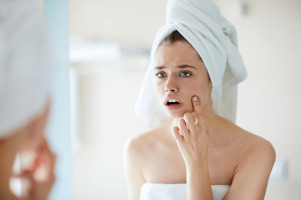 Is Your Skin Purging?