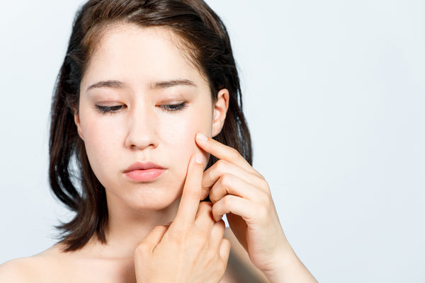 How to Stop Skin Picking 